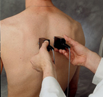 Параспинальное EMG исследование